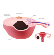 子宮内膜症について