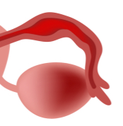 卵管留水腫について