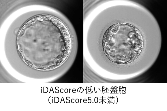 iDAScoreの低い胚盤胞