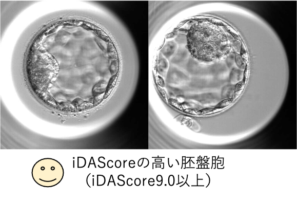 iDAScoreの高い胚盤胞