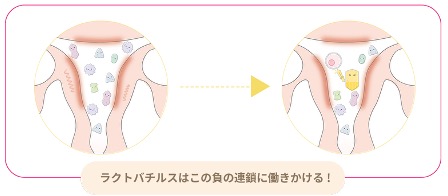 子宮内フローラについて