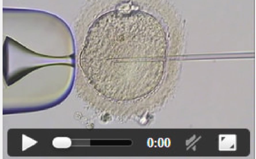 実際の顕微授精